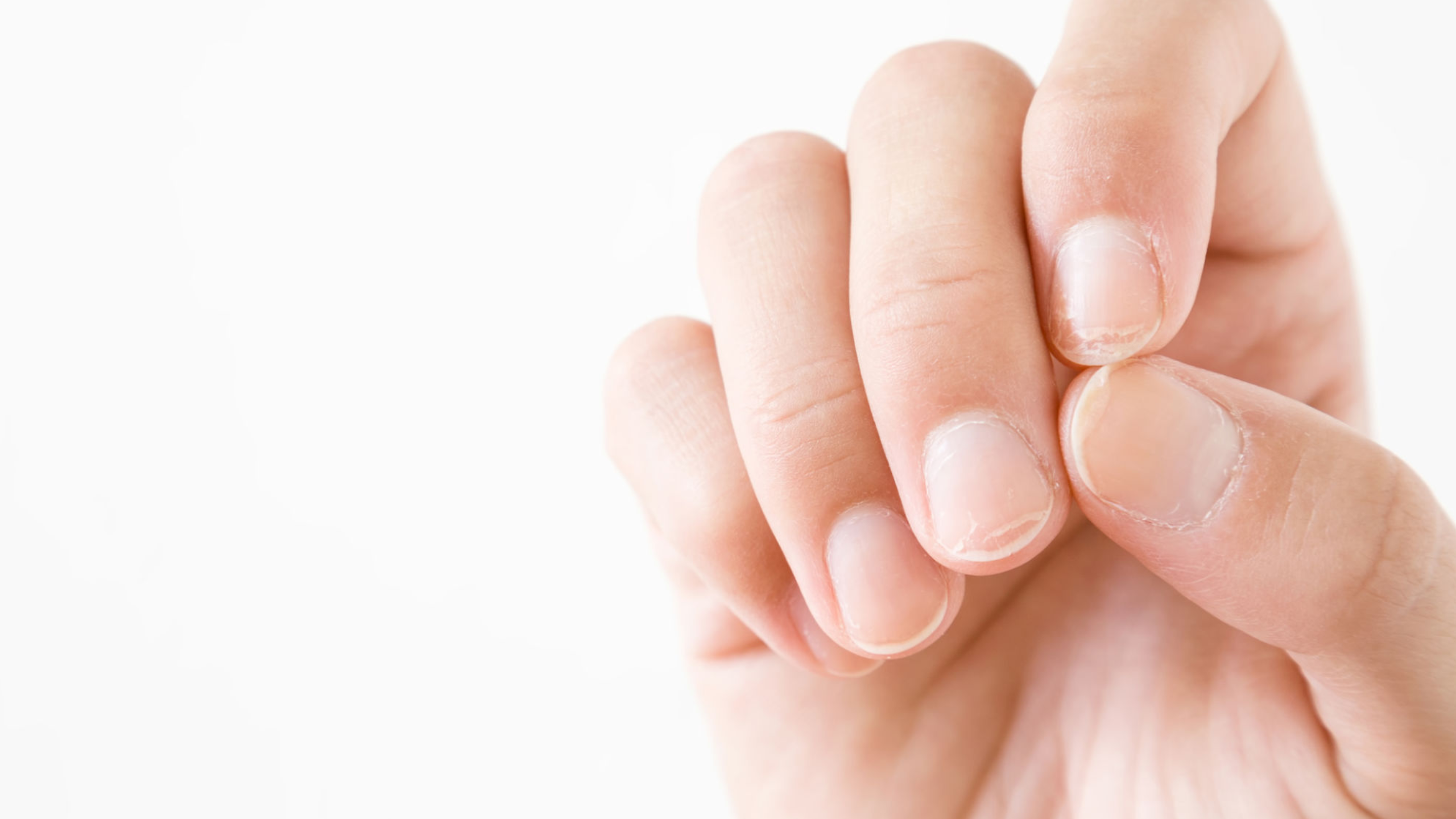 Do You Have Brittle Nails? Here's What Might Be Causing Them and How to Fix the Problem!